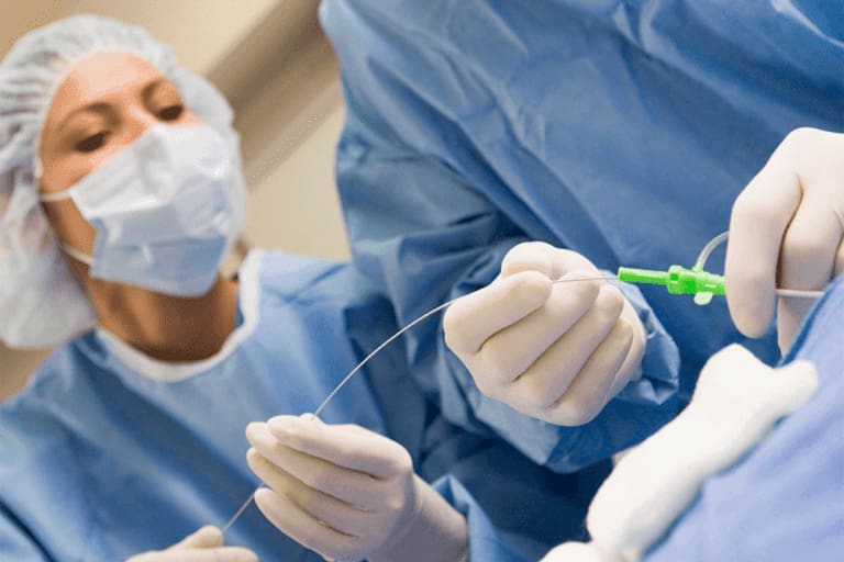 Medical professionals in surgical attire perform a procedure, focusing on inserting a catheter.